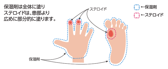 バイエルベターライフナビ バイエル薬品