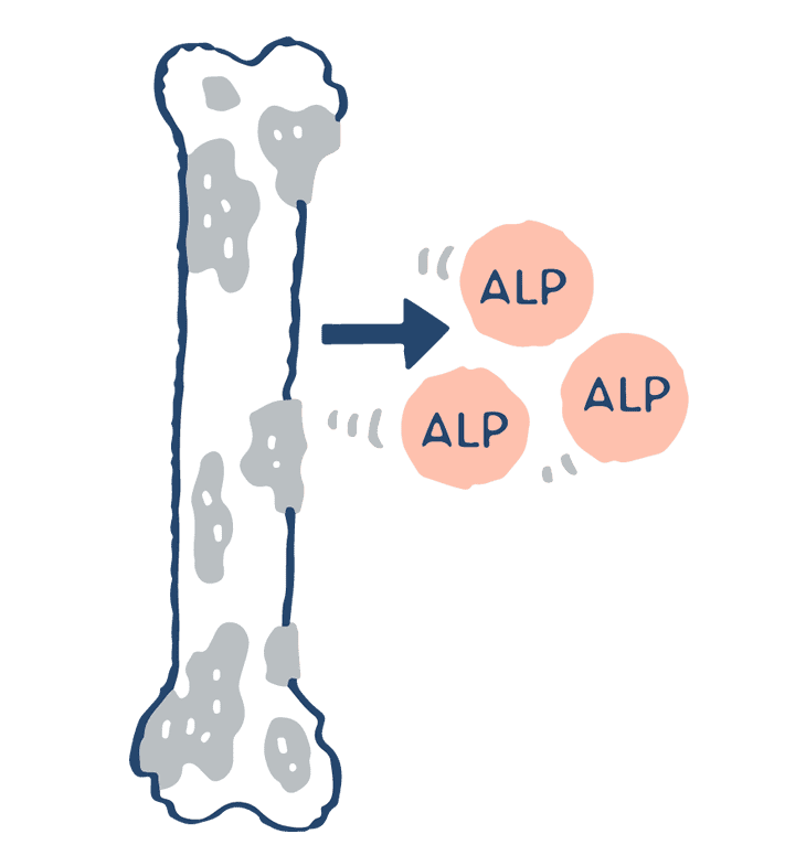 前立腺がんとALP値はどのような関係がありますか？